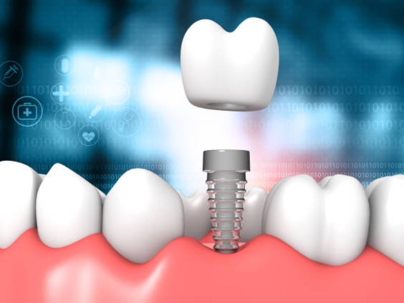 Smile in Search Mastering SEO for Orthodontic Practices That Stand Out