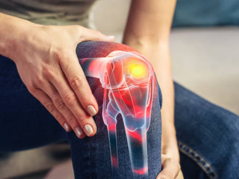 A Comprehensive Guide to Orthopedic Marketing Success