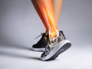 SEO for Orthopedics Your Key to Obtaining More Patients